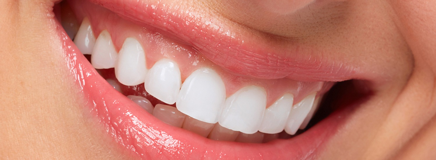 EN LEFKO οδοντόκρεμα λεύκανσης - πρόληψης - αντιμετώπισης - Image 2